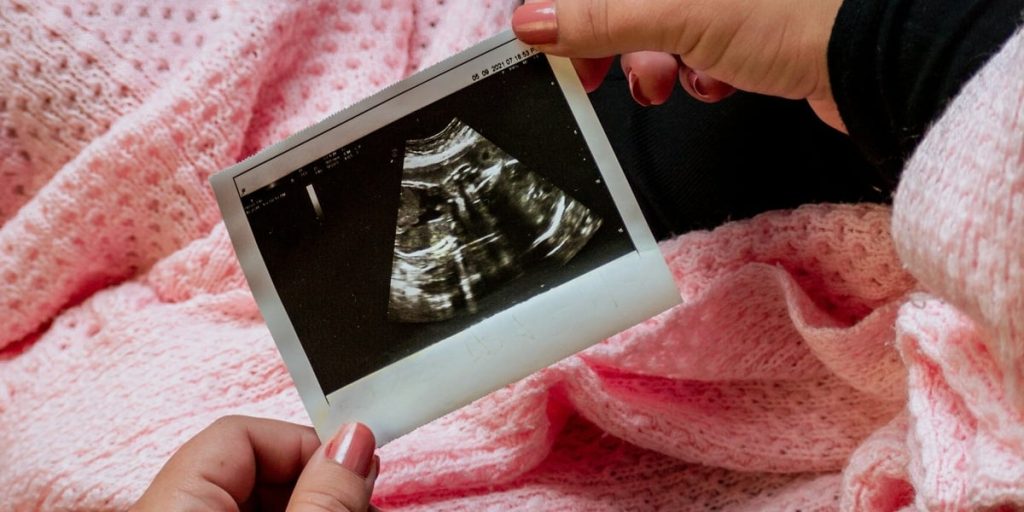 'Lei do Batimento Card&iacute;aco' salva 23.000 beb&ecirc;s do aborto, na Fl&oacute;rida