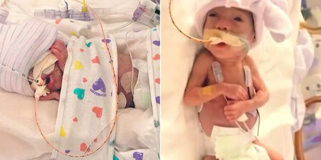 &ldquo;Deus foi fiel&rdquo;: Beb&ecirc; que nasceu com 23 semanas sobrevive e desafia a medicina